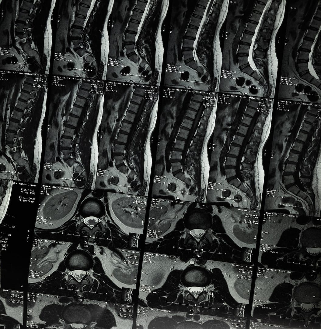 x ray of spine