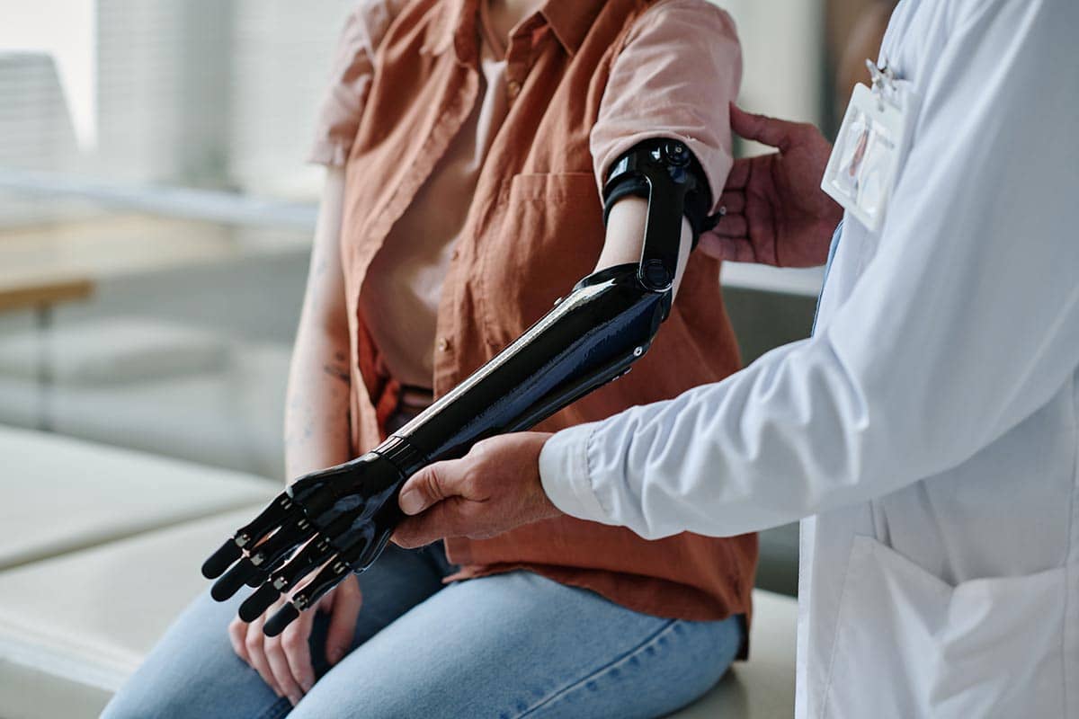 doctor fitting prosthetic arm