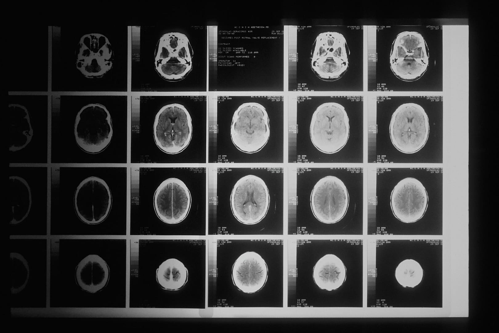 A collection of scans of a brain