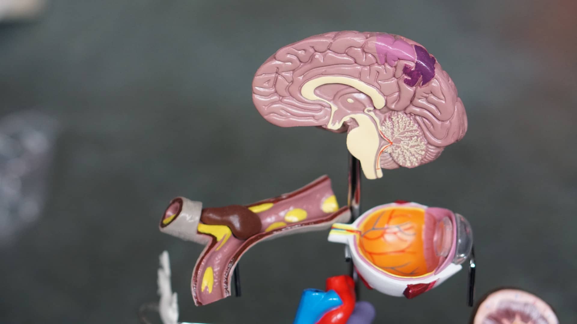 A 3d print of a brain