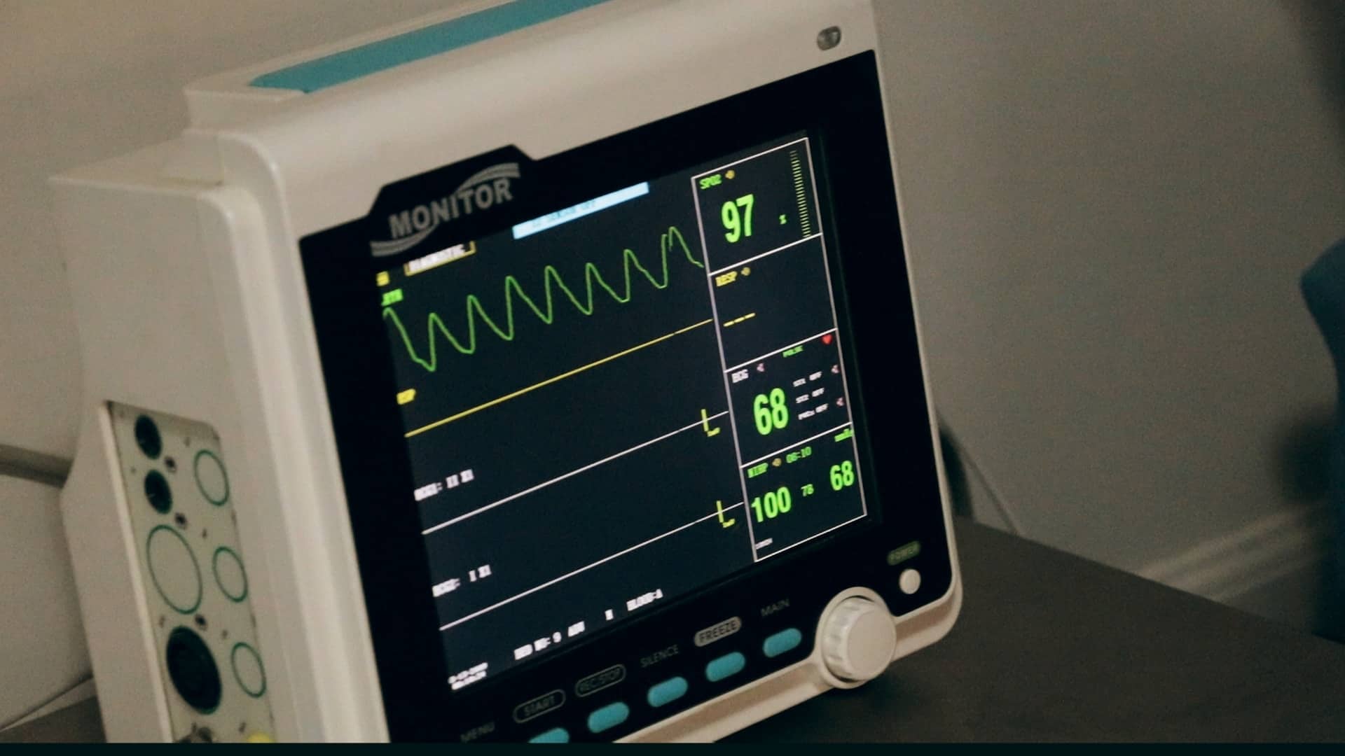 a cardiac monitor