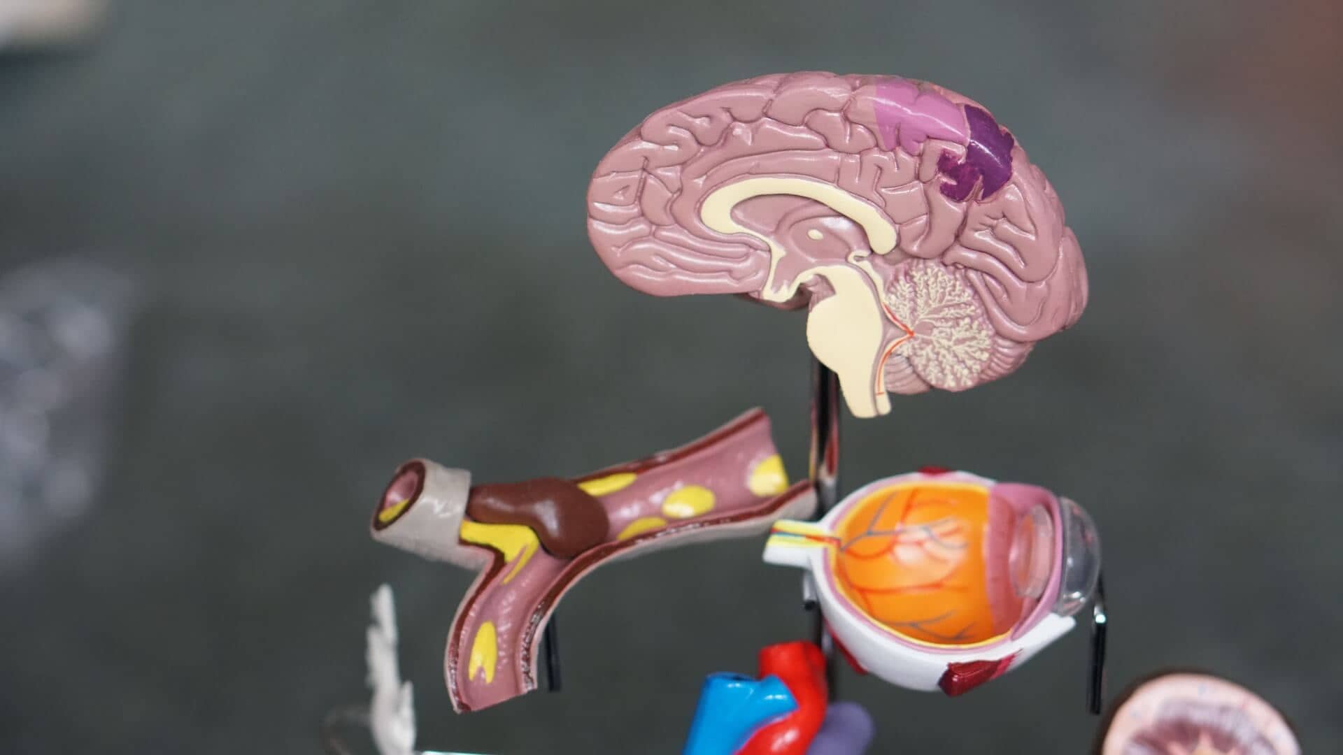 A 3D model of a brain