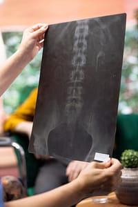 Spinal Injuries