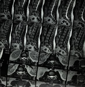 x ray of spine