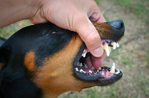 Dog Bite Injury