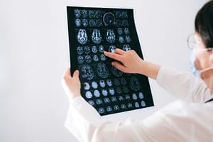 Neurorehabilitation