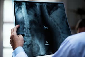 Spinal Injury Claims