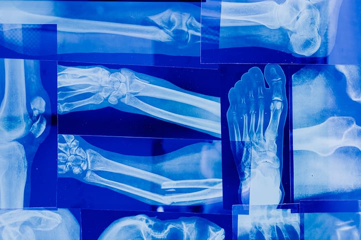 A collection of x-rays