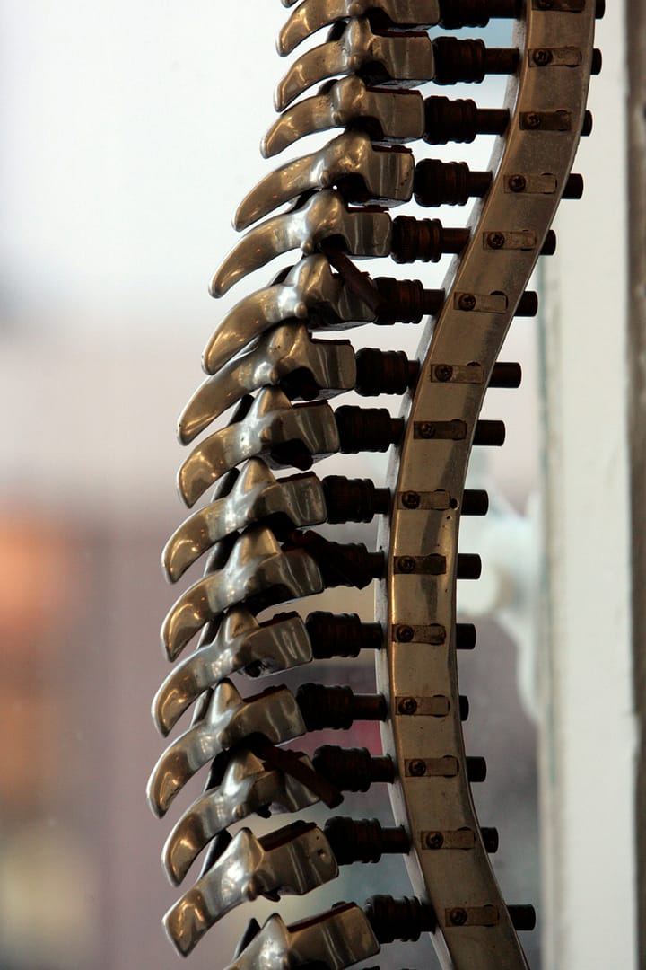 Minor spinal injury