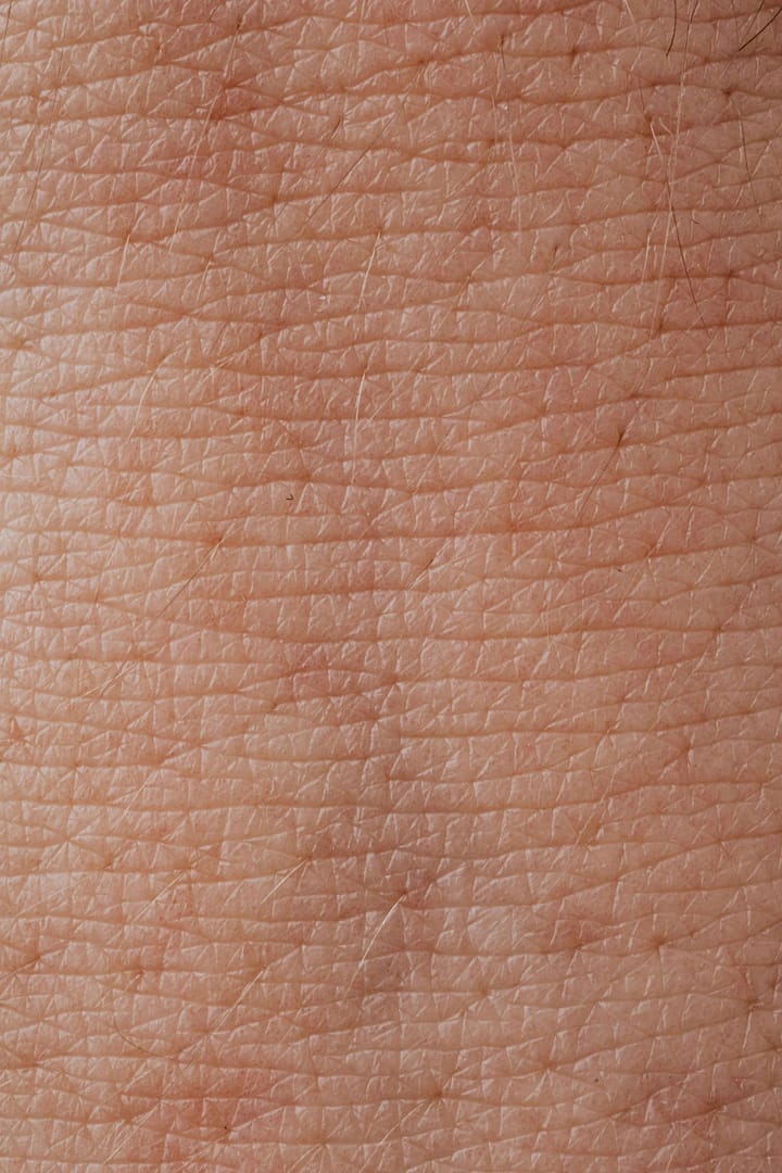 Dermatitis in the UK