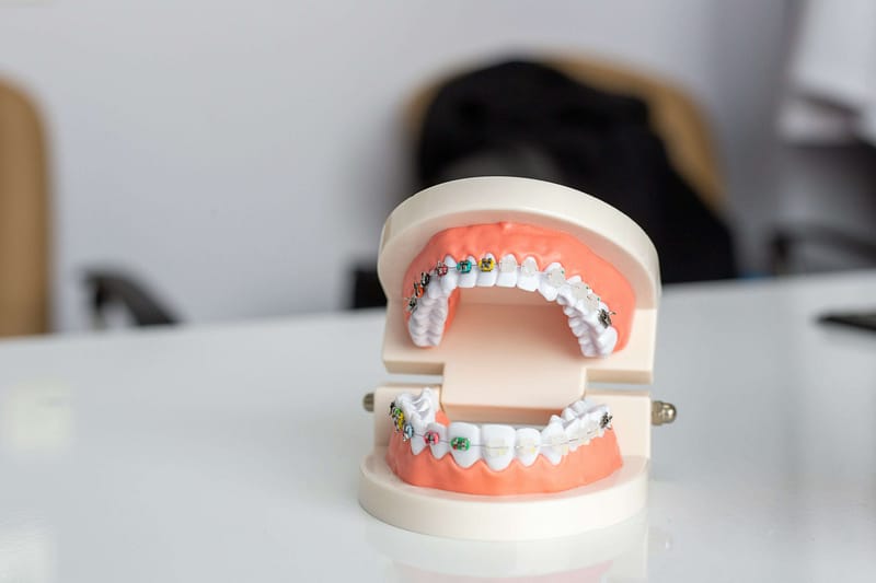 Dental Negligence