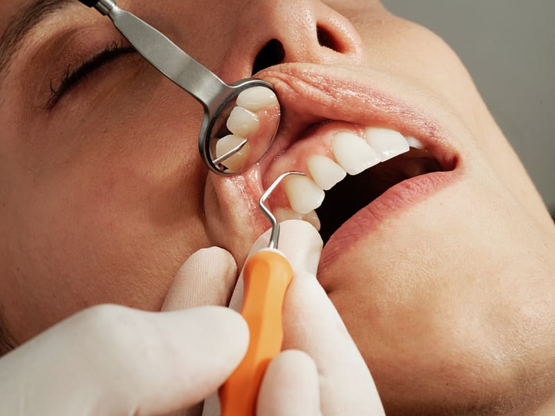 Someone attending a dental check up