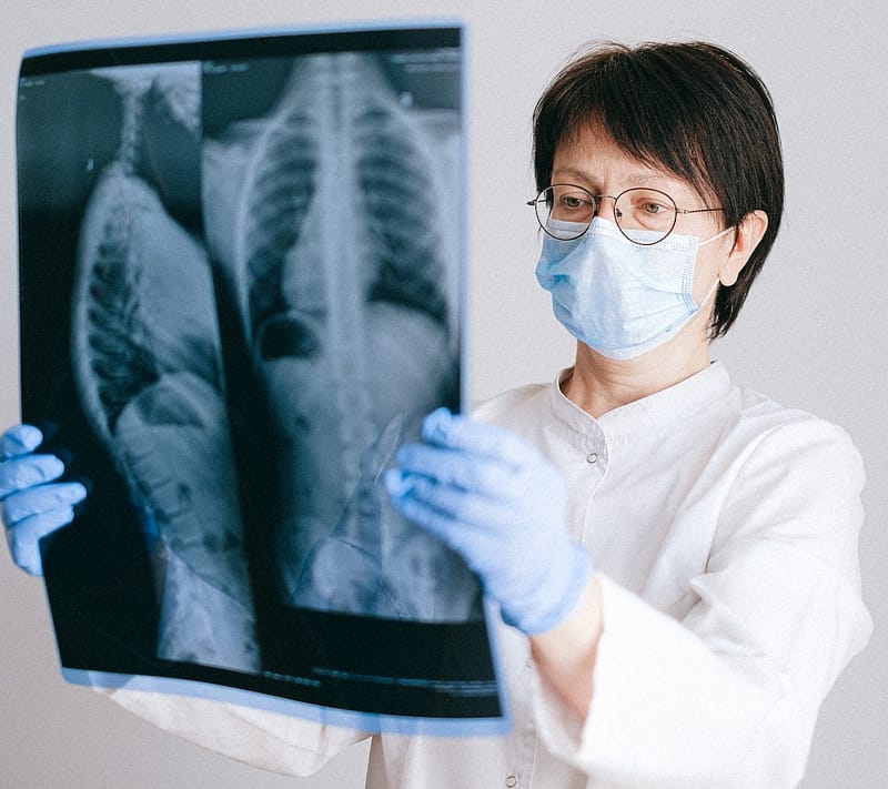 A doctor looking at an x ray